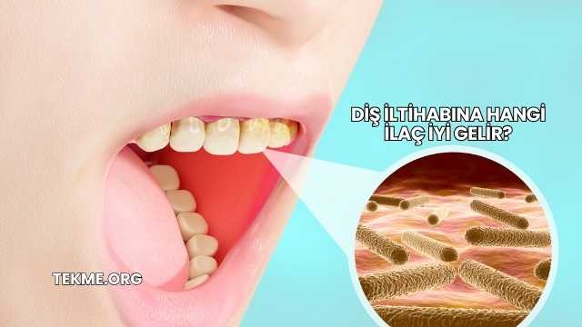 Diş İltihabına Hangi İlaç İyi Gelir?