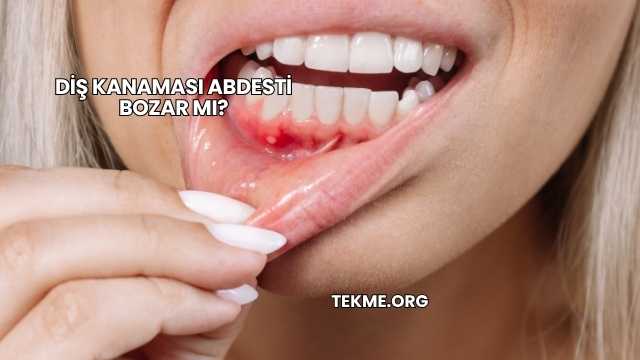 Diş Kanaması Abdesti Bozar mı?