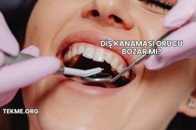 Diş Kanaması Orucu Bozar mı?