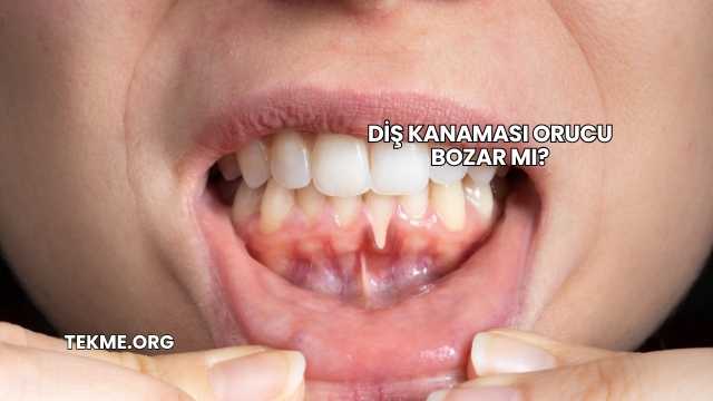Diş Kanaması Orucu Bozar mı?