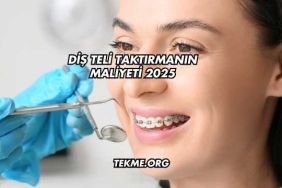 Diş Teli Taktırmanın Maliyeti 2025