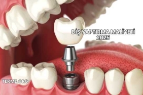 Diş Yaptırma Maliyeti 2025