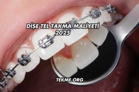 Dişe Tel Takma Maliyeti 2025