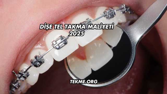 Dişe Tel Takma Maliyeti 2025