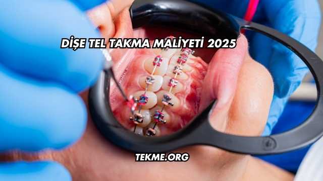 Dişe Tel Takma Maliyeti 2025