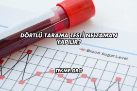 Dörtlü Tarama Testi Ne Zaman Yapılır?