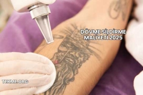 Dövme Sildirme Maliyeti 2025