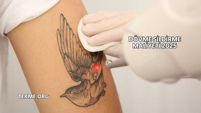 Dövme Sildirme Maliyeti 2025