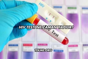 HIV Testi Ne Zaman Yapılır?