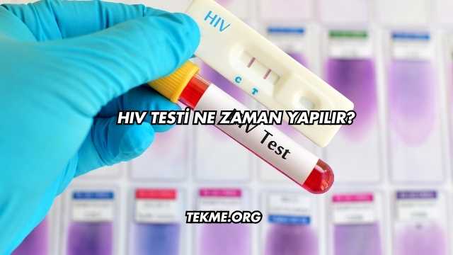 HIV Testi Ne Zaman Yapılır?