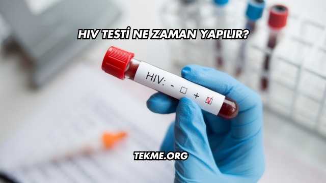 HIV Testi Ne Zaman Yapılır?