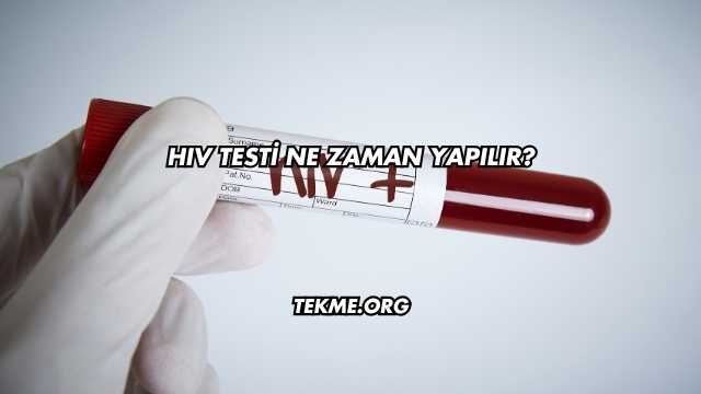 HIV Testi Ne Zaman Yapılır?