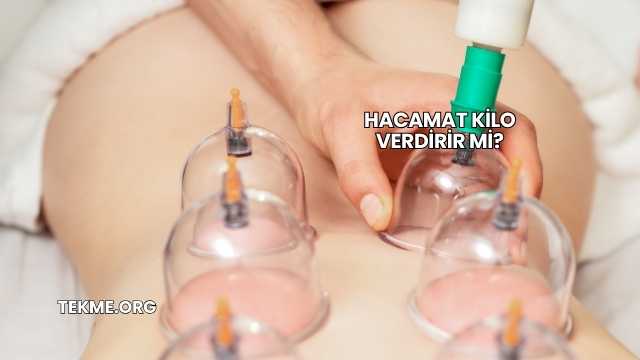 Hacamat Kilo Verdirir mi?