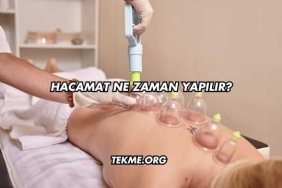Hacamat Ne Zaman Yapılır?