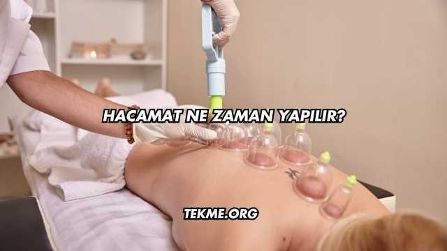 Hacamat Ne Zaman Yapılır?