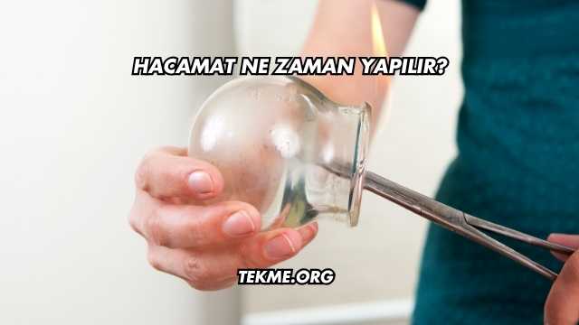 Hacamat Ne Zaman Yapılır?