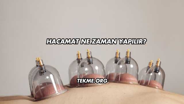 Hacamat Ne Zaman Yapılır?