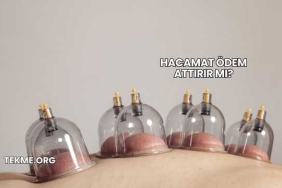 Hacamat Ödem Attırır mı?