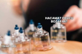 Hacamat Orucu Bozar mı?