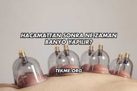 Hacamattan Sonra Ne Zaman Banyo Yapılır?