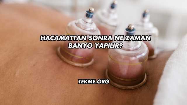 Hacamattan Sonra Ne Zaman Banyo Yapılır?