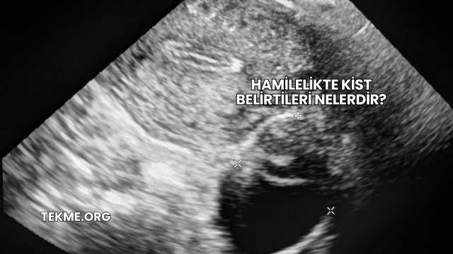 Hamilelikte Kist Belirtileri Nelerdir?