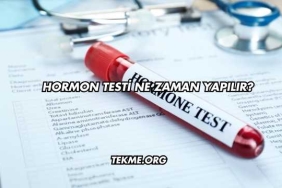 Hormon Testi Ne Zaman Yapılır?