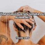 İğne Vurulduktan Sonra Duş Alınır mı?
