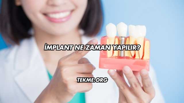 İmplant Ne Zaman Yapılır?