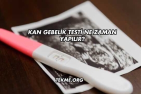 Kan Gebelik Testi Ne Zaman Yapılır?