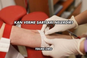 Kan Verme Şartları Nelerdir?
