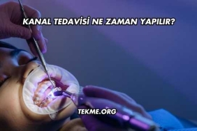 Kanal Tedavisi Ne Zaman Yapılır?
