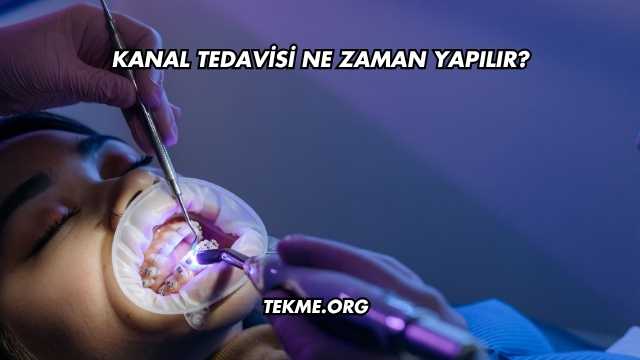 Kanal Tedavisi Ne Zaman Yapılır?