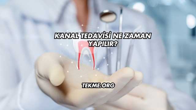 Kanal Tedavisi Ne Zaman Yapılır?