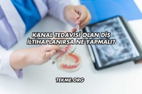 Kanal Tedavisi Olan Diş İltihaplanırsa Ne Yapmalı?