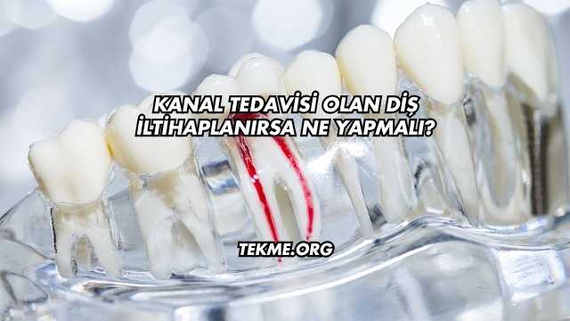 Kanal Tedavisi Olan Diş İltihaplanırsa Ne Yapmalı?