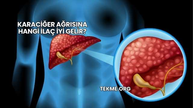 Karaciğer Ağrısına Hangi İlaç İyi Gelir?