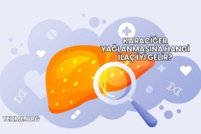 Karaciğer Yağlanmasına Hangi İlaç İyi Gelir?