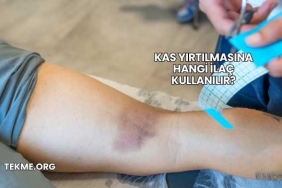 Kas Yırtılmasına Hangi İlaç Kullanılır?