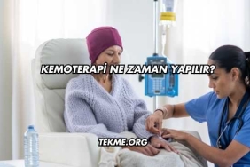 Kemoterapi Ne Zaman Yapılır?