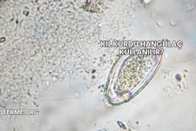 Kıl Kurdu Hangi İlaç Kullanılır?