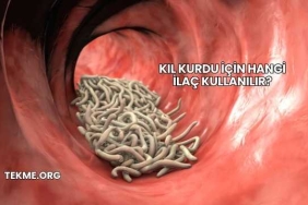 Kıl Kurdu İçin Hangi İlaç Kullanılır?