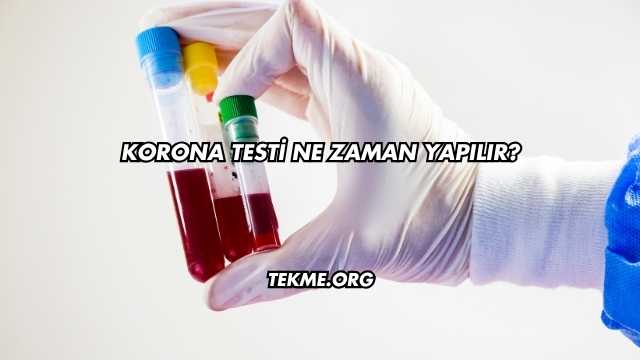 Korona Testi Ne Zaman Yapılır?