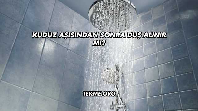 Kuduz Aşısından Sonra Duş Alınır mı?