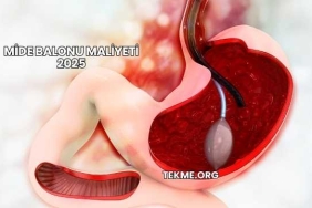 Mide Balonu Maliyeti 2025