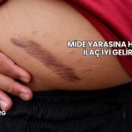 Mide Yarasına Hangi İlaç İyi Gelir?