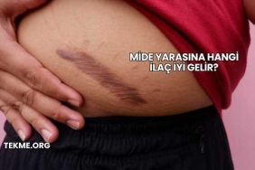 Mide Yarasına Hangi İlaç İyi Gelir?