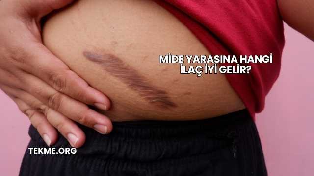 Mide Yarasına Hangi İlaç İyi Gelir?