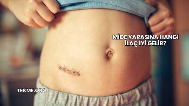 Mide Yarasına Hangi İlaç İyi Gelir?