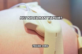 NST Ne Zaman Yapılır?